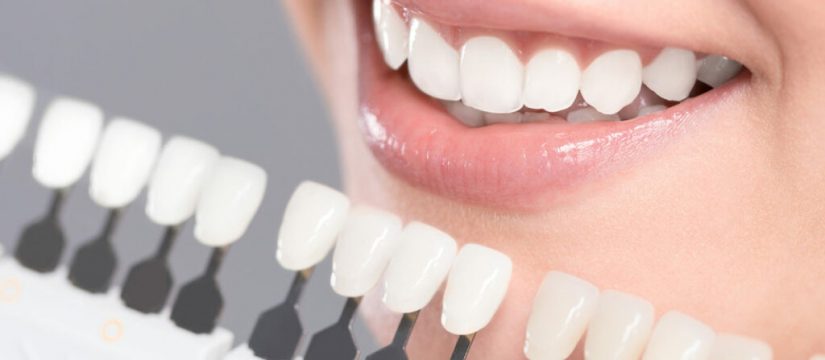 What is a Dental Crown?